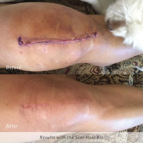 Before and after result