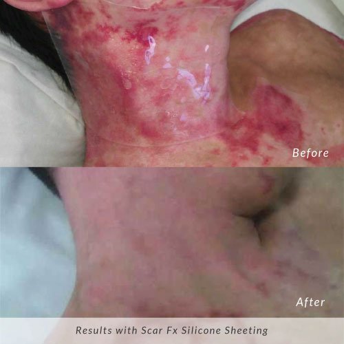 Before and after result