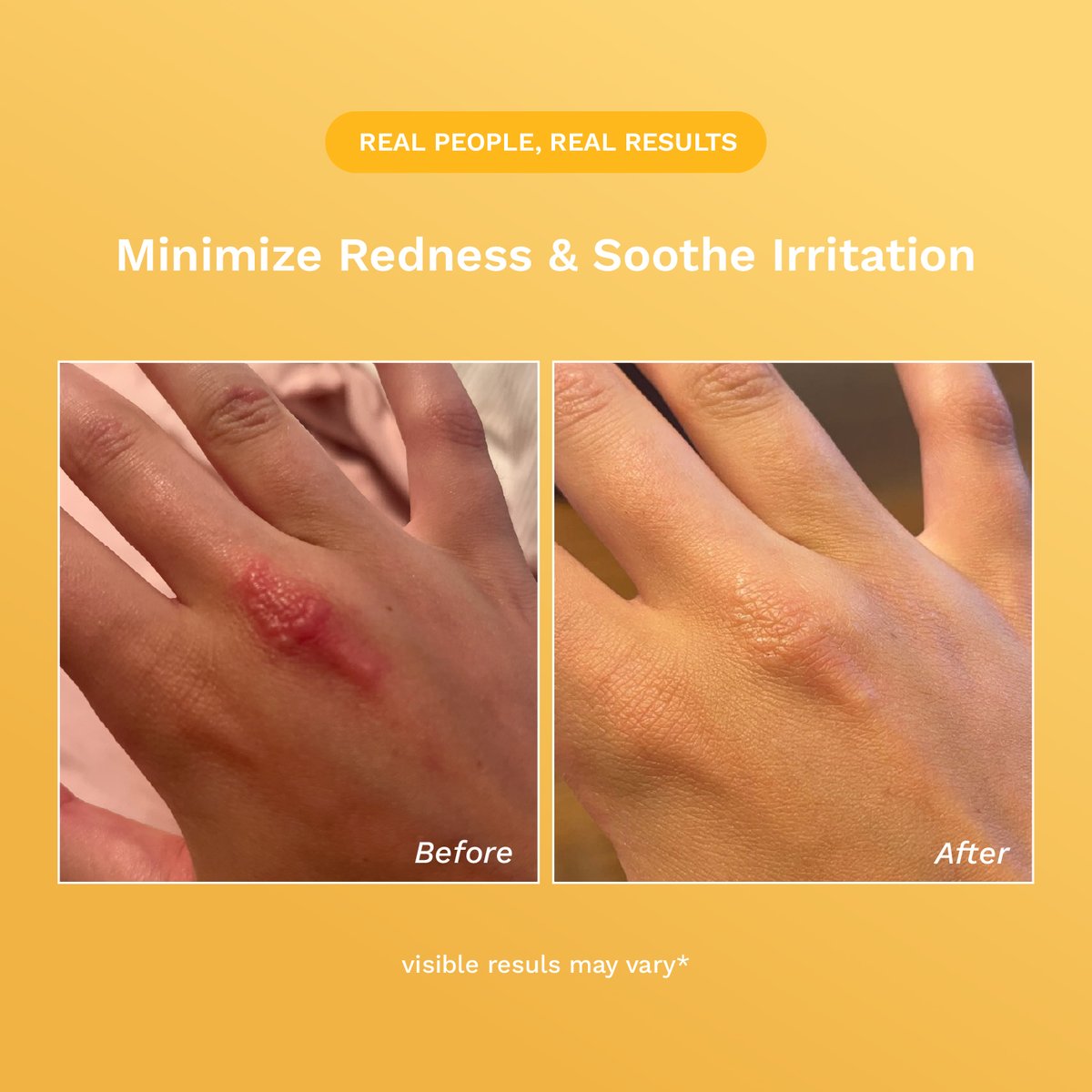 Before and after result