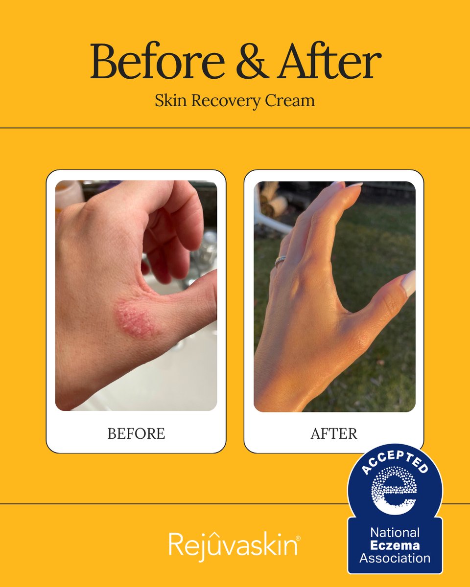 Before and after result